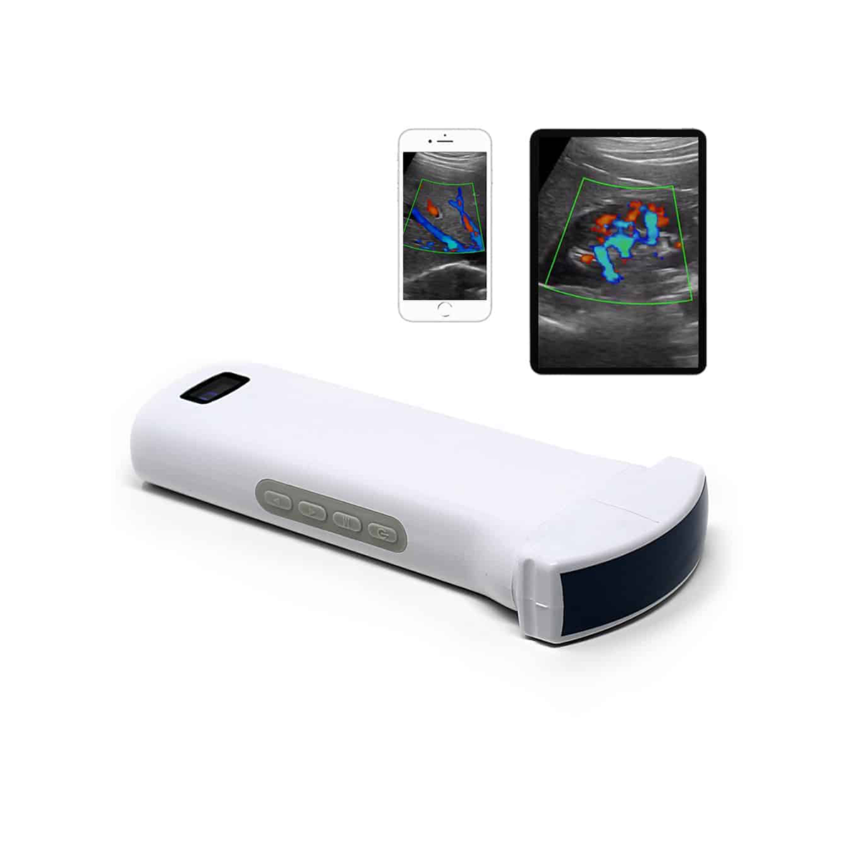 ASSISTENCIA TECNICA AUTORIZADA TRANSDUTOR TRANSESOFAGICO SONOQUE