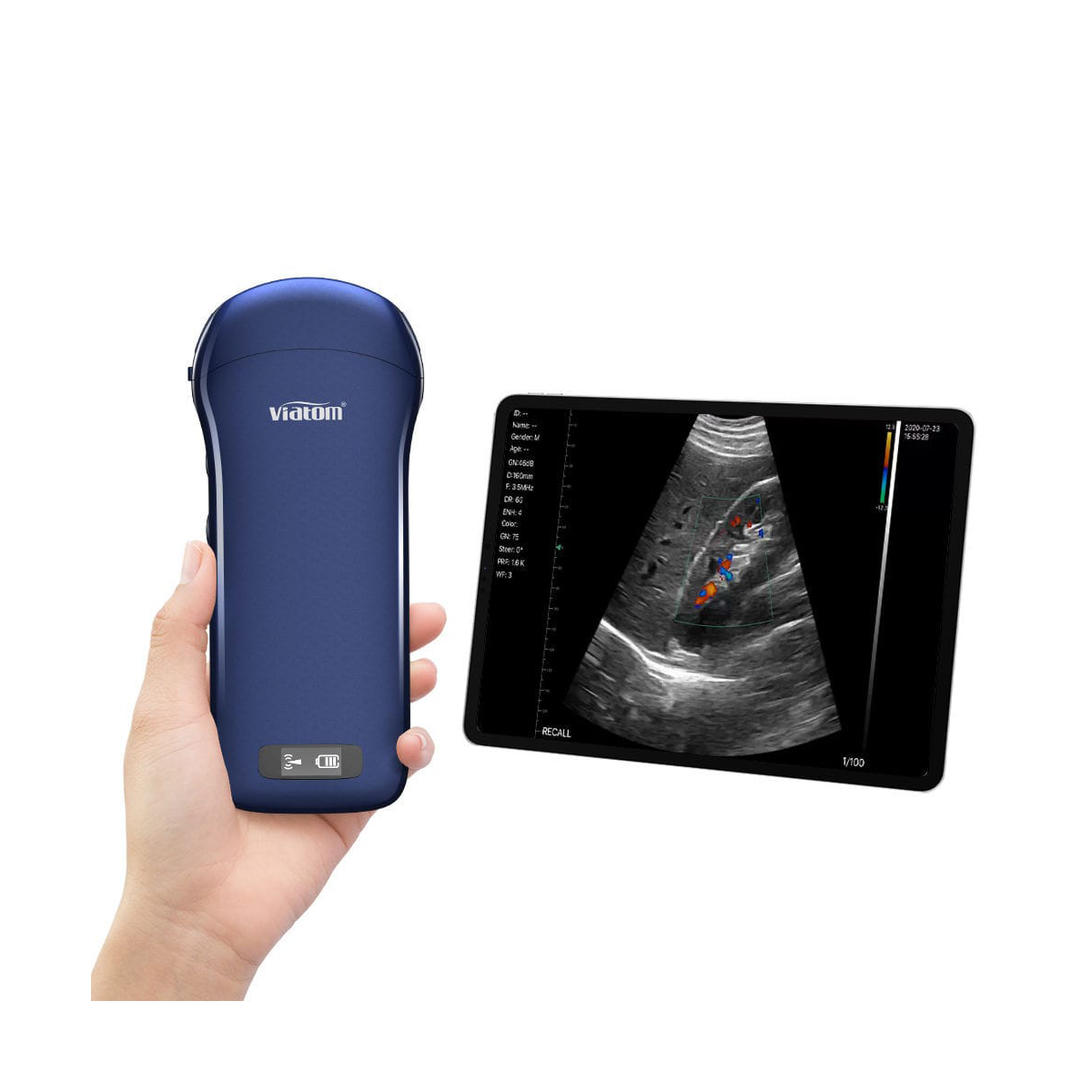ASSISTENCIA TECNICA AUTORIZADA TRANSDUTOR TRANSESOFAGICO VIATOM