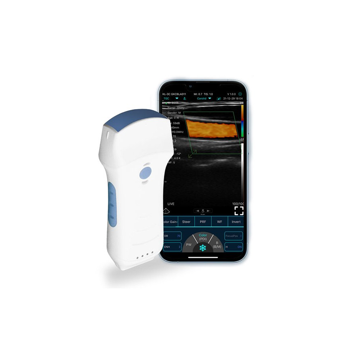 TROCA CRISTAIS TRANSDUTOR TRANSESOFAGICO KONTED