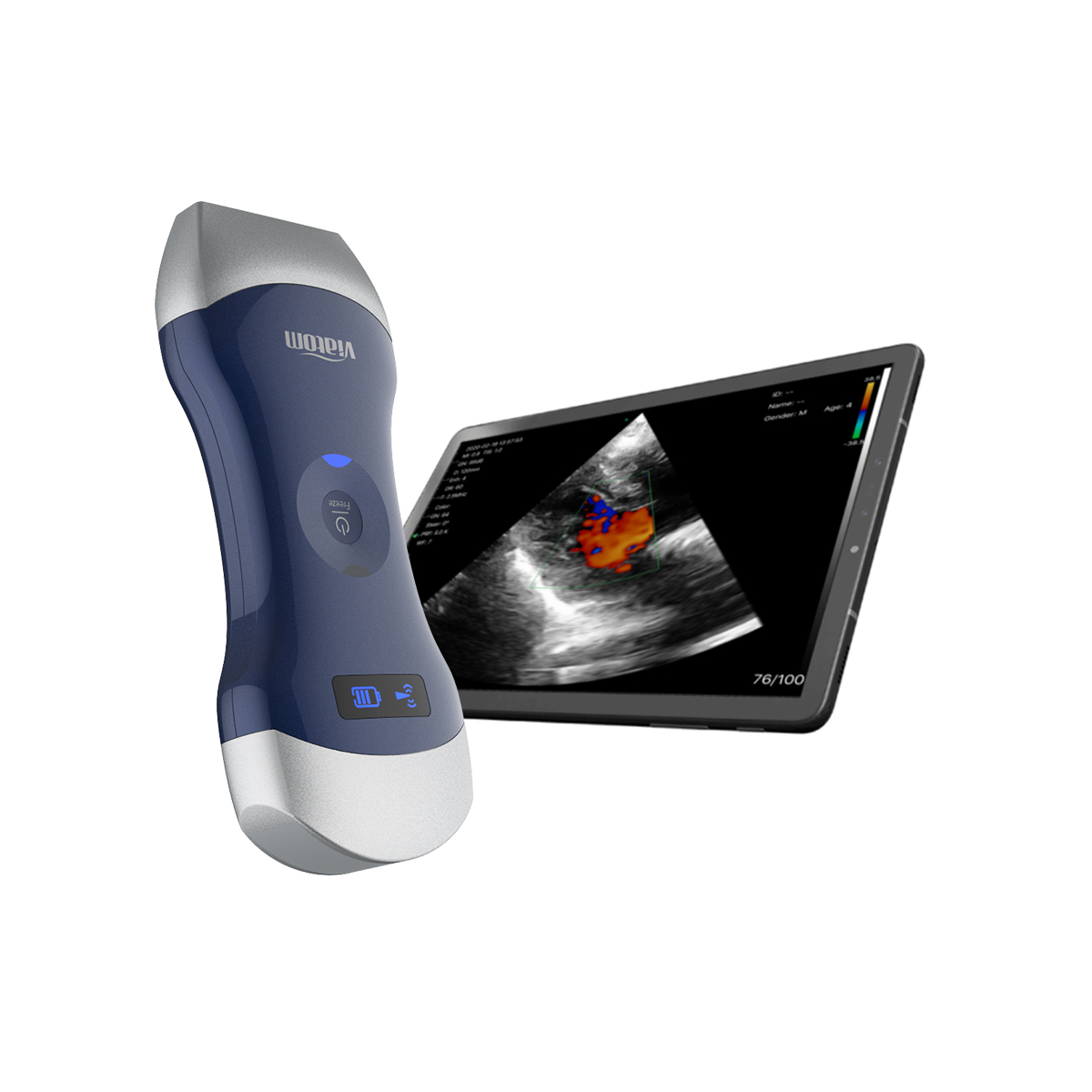 TROCA CRISTAIS TRANSDUTOR TRANSESOFAGICO VIATOM